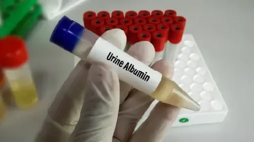 Albumin in Urine - Symptoms, Causes and Prevention